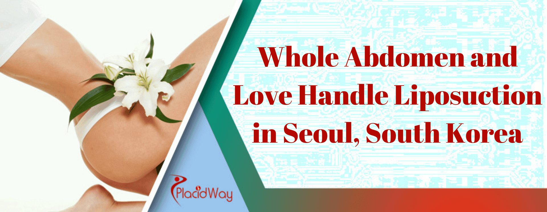 Whole Abdomen and Love Handle Liposuction in Seoul, South Korea
